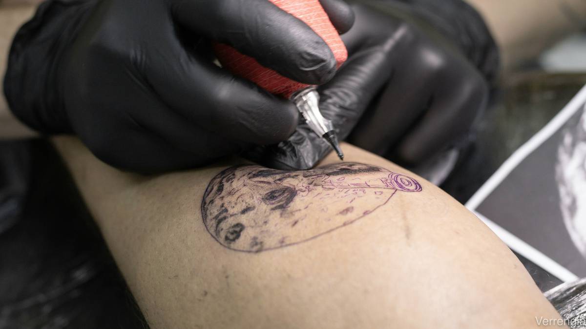 Close-up of a peeling tattoo showing damaged ink lines