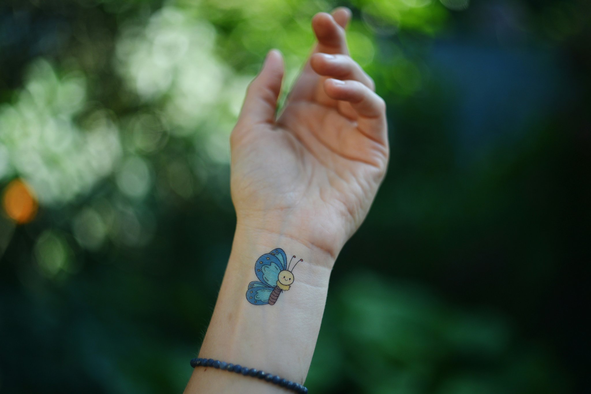 Severely infected tattoo causing widespread discoloration and swelling
