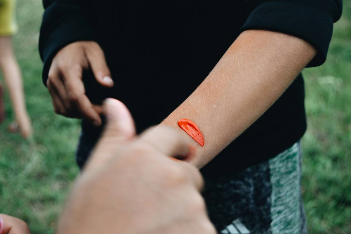 Close-up of inflamed skin around a vibrant red gaming tattoo showing swelling and small blisters — tattoo allergy